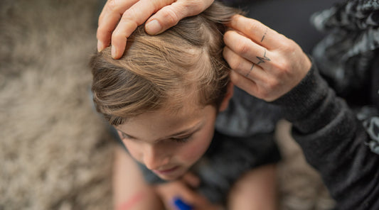 Treating Head Lice: What You Need to Know